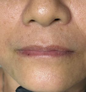 before after healed lip liner tattoo