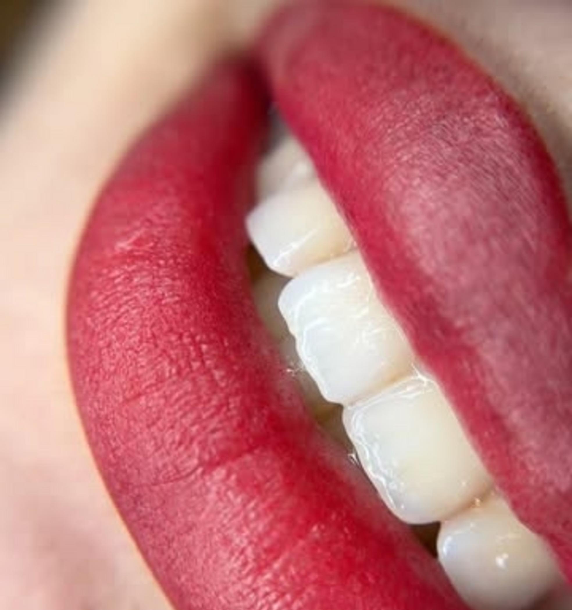 Lip Liner Tattoo For Cupid’s Bow: Can It Restore A Faded Lip Border?