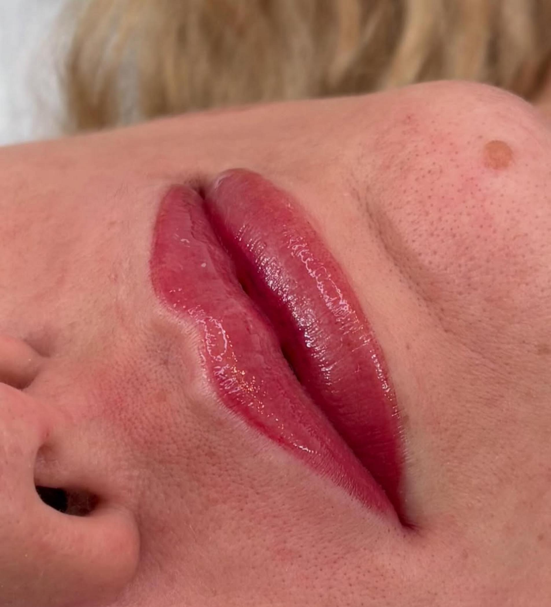 close up lips with fading pigment