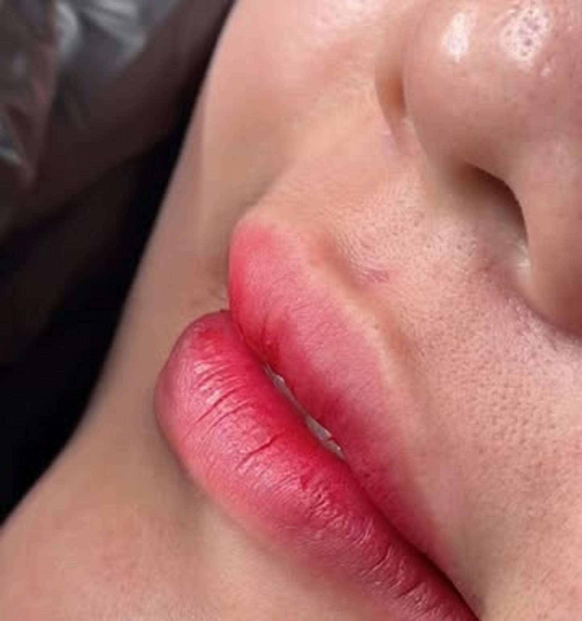 cosmetic tattoo artist applying lips