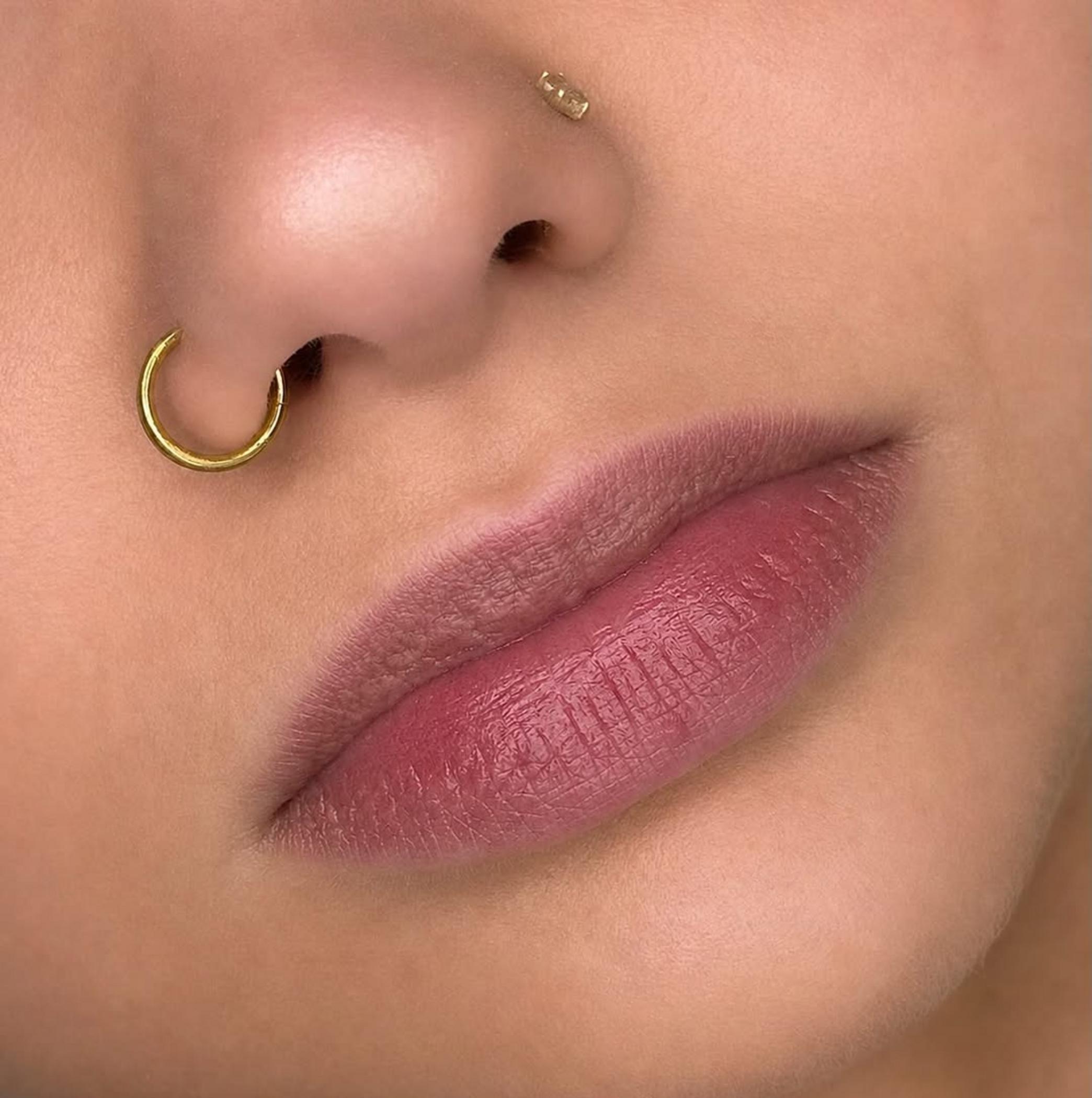 Dark Lip Neutralisation Cost Australia: 3-Session City Guide