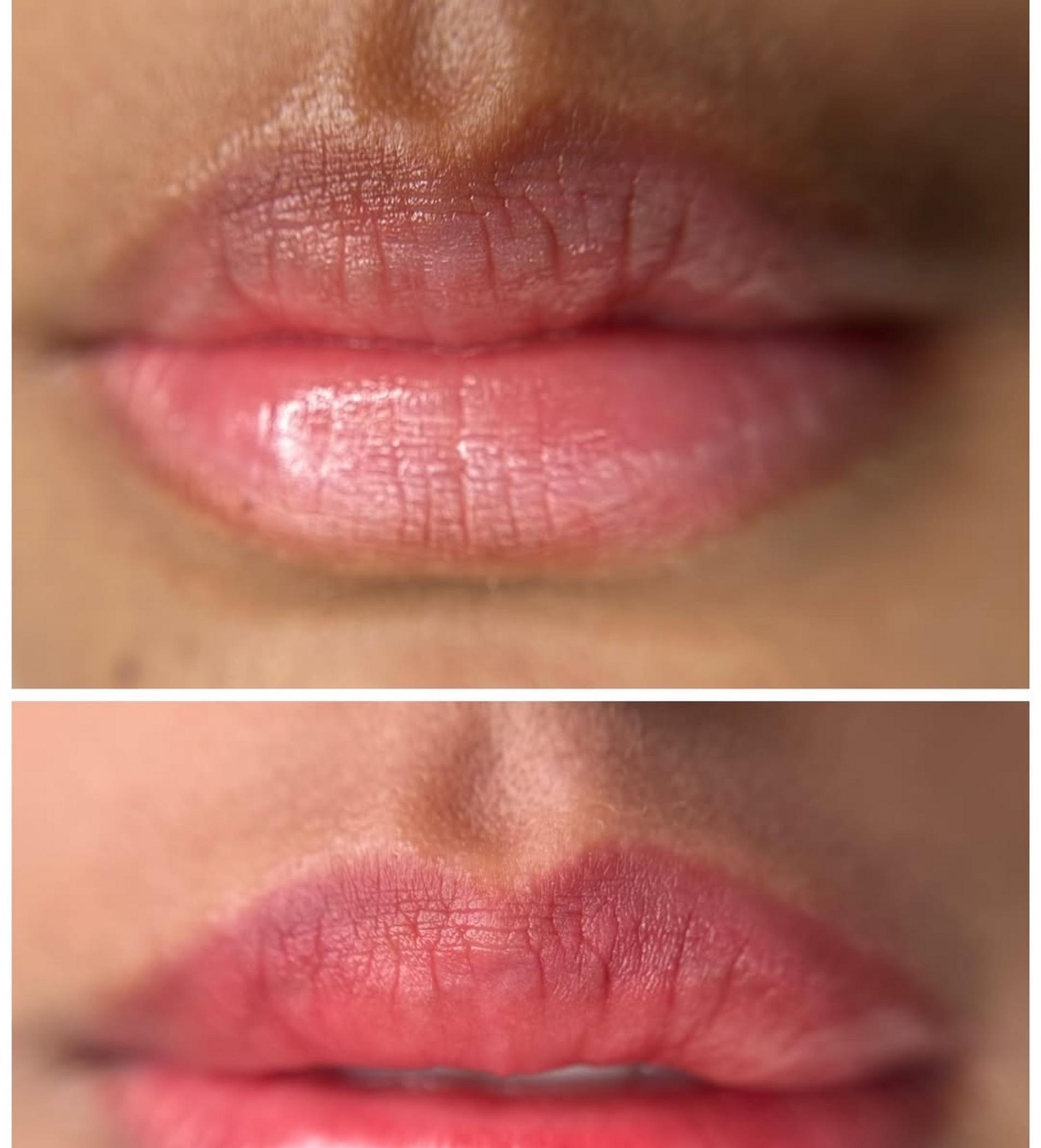 healing stages lip micropigmentation