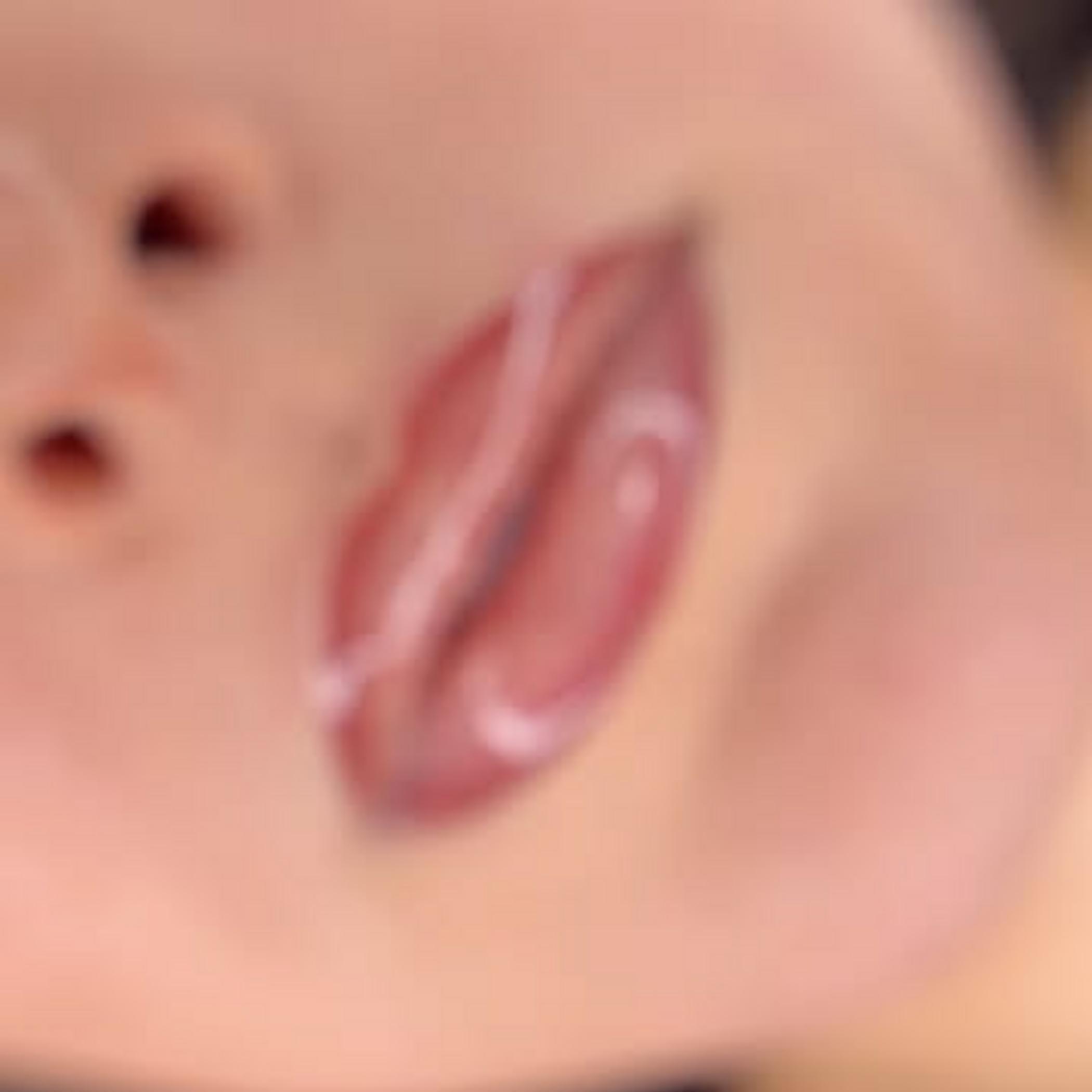 healing stages lip neutralisation melanin rich