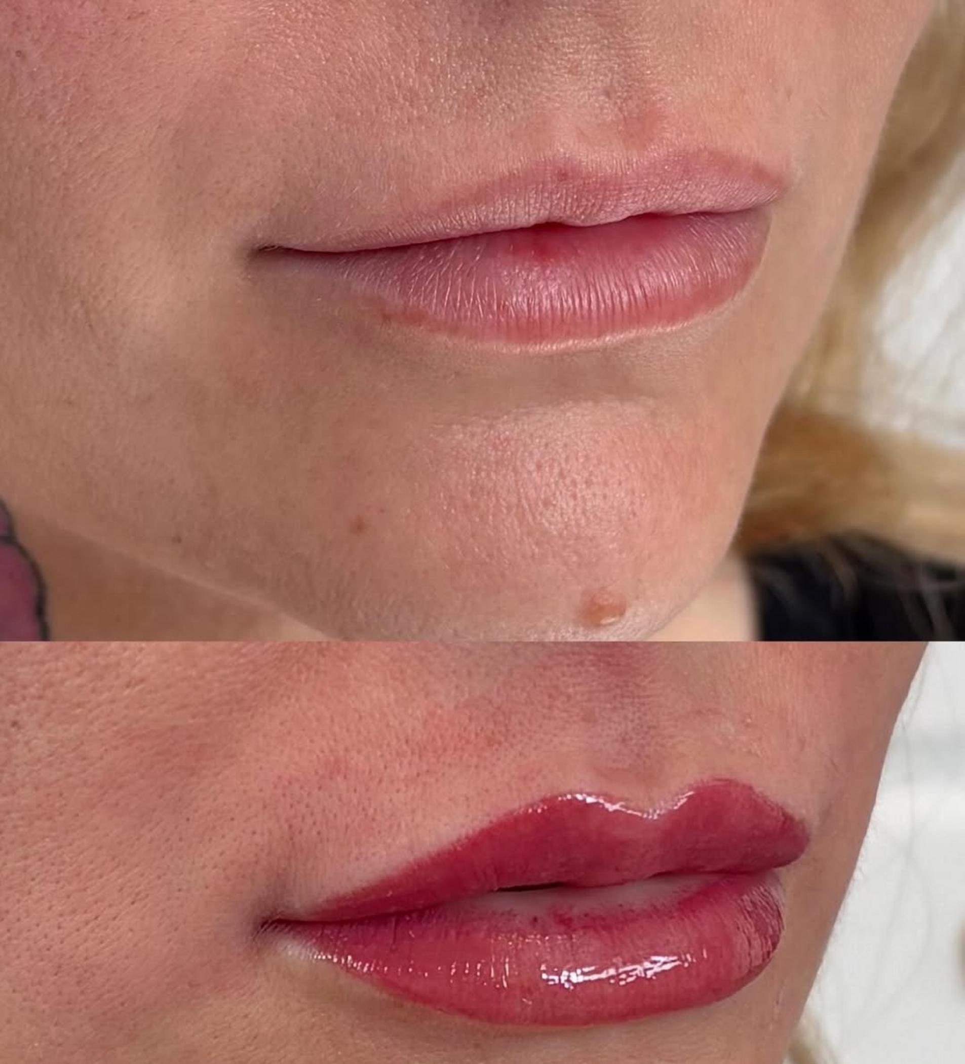 lip blush procedure numbing application