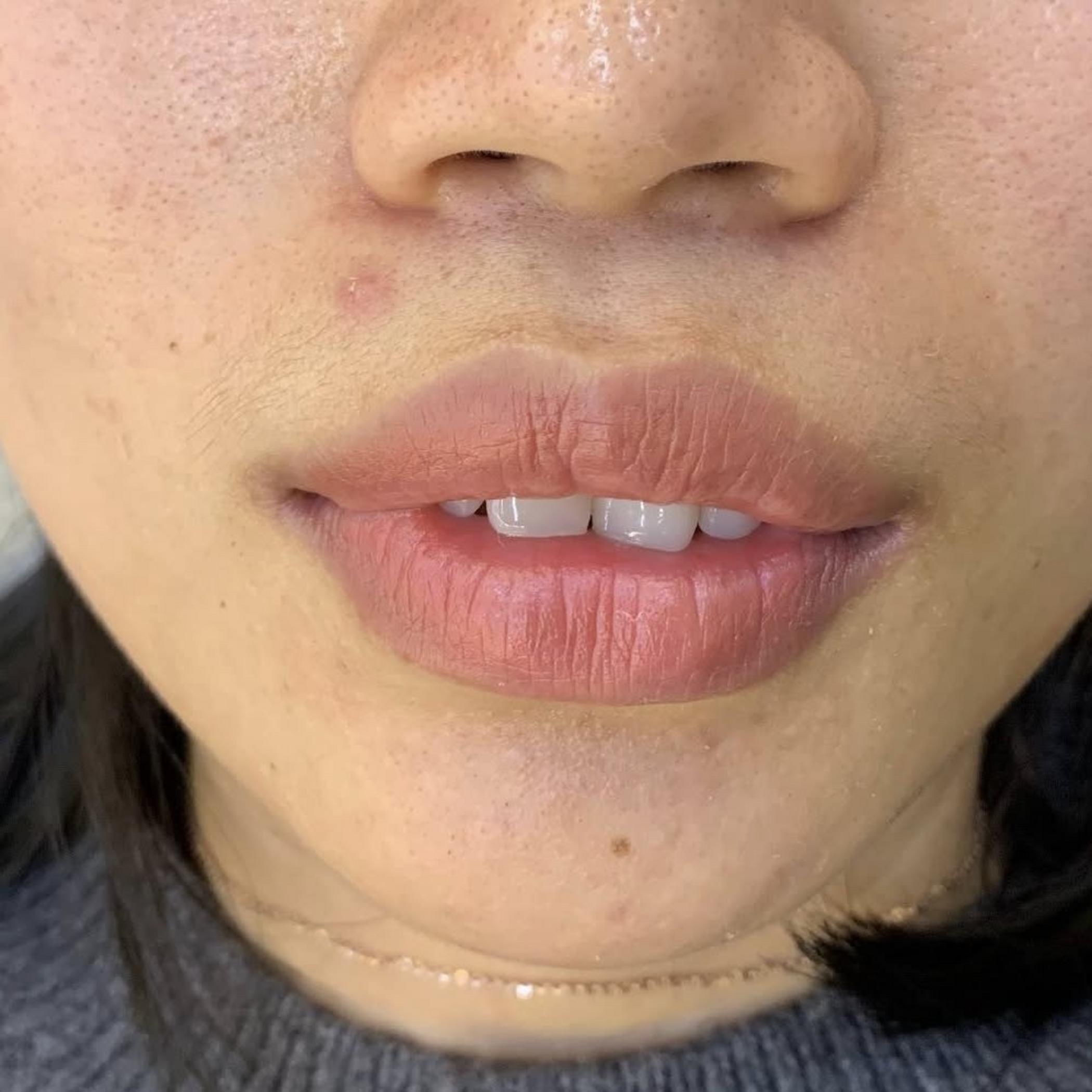lip blush tattoo healing stage photo