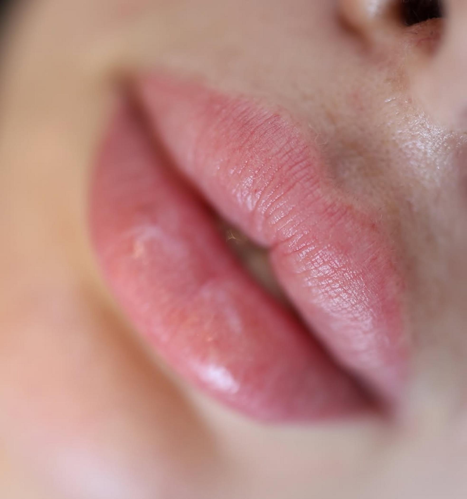 lip liner tattoo procedure step by step