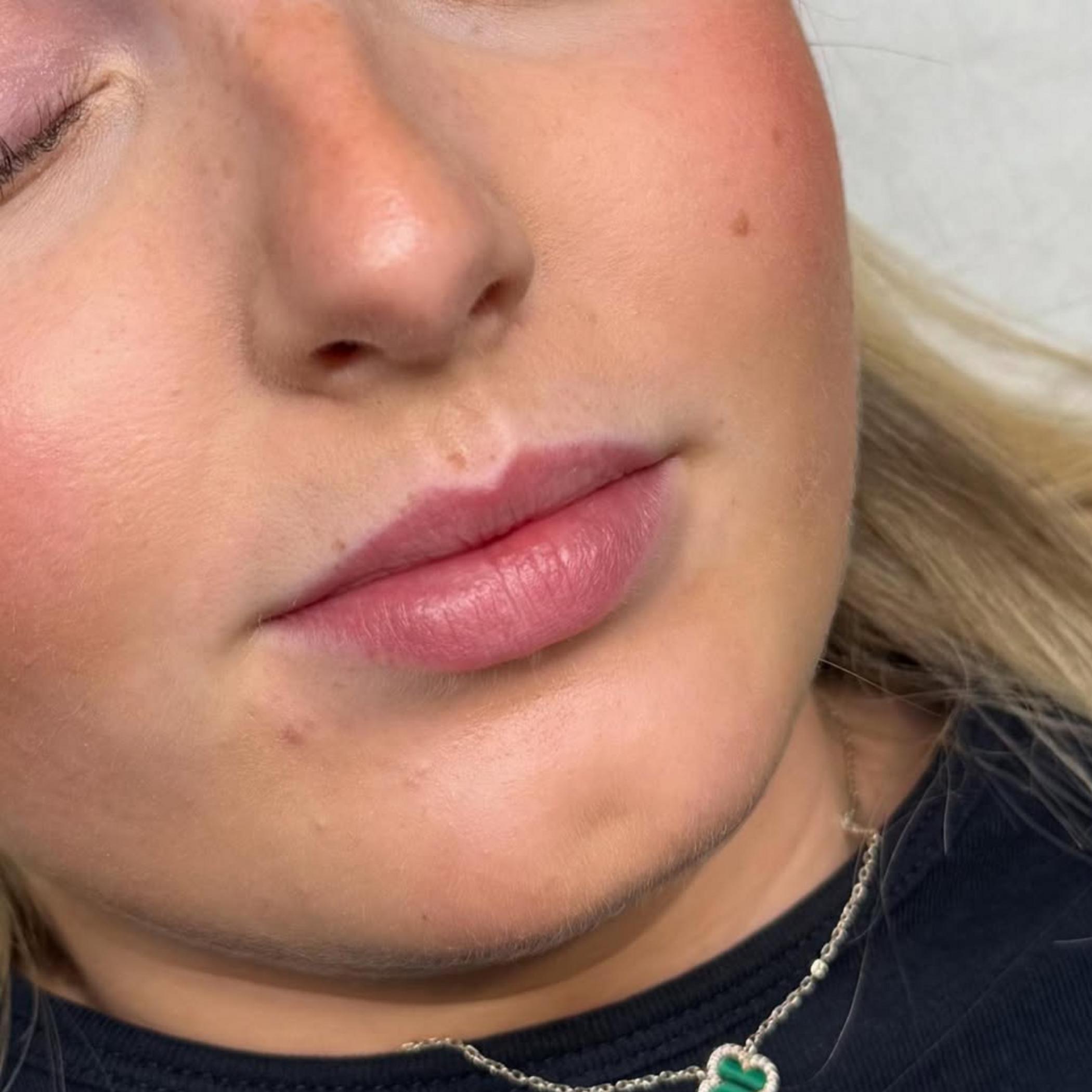 natural lip blush healed results