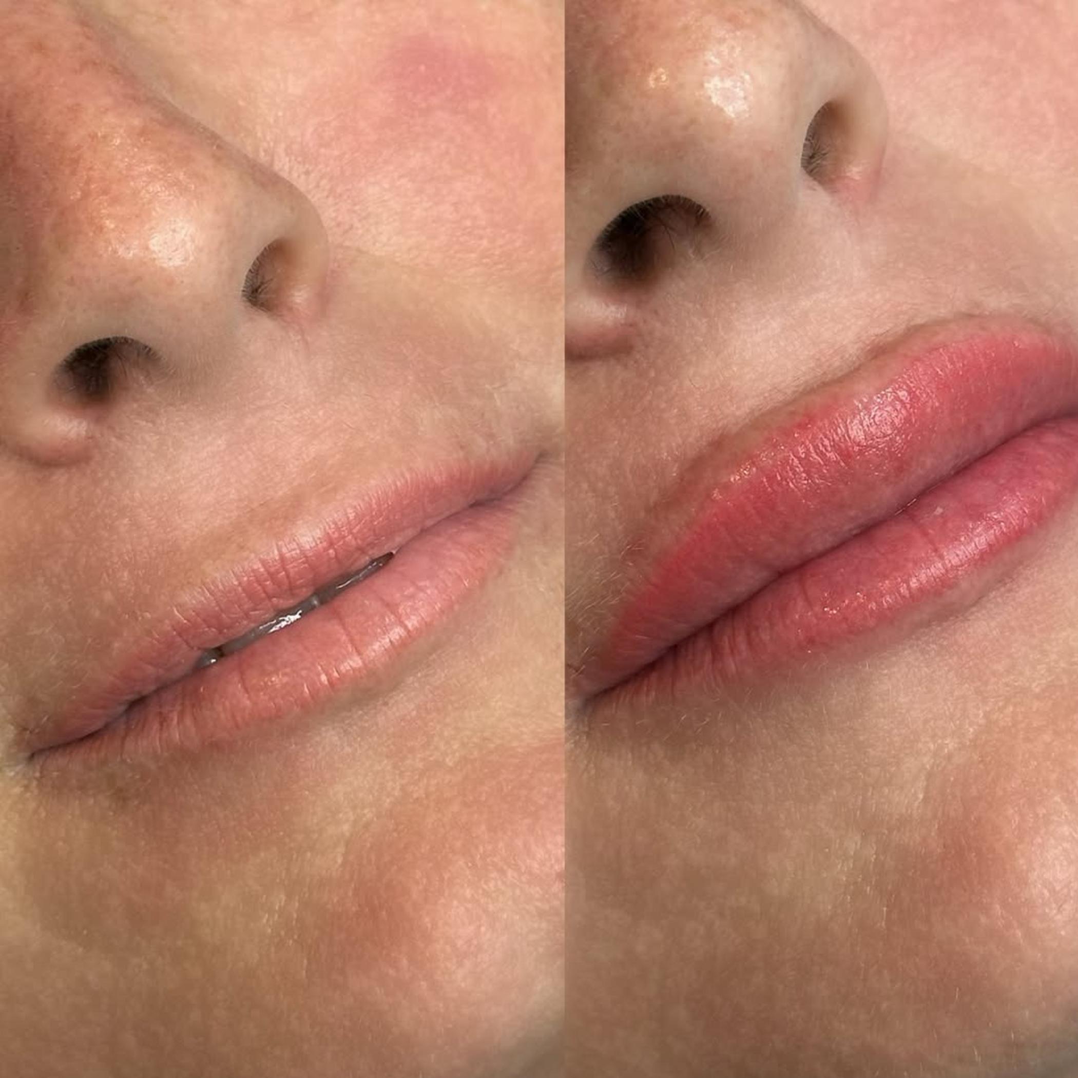 natural melanin rich lip colour results