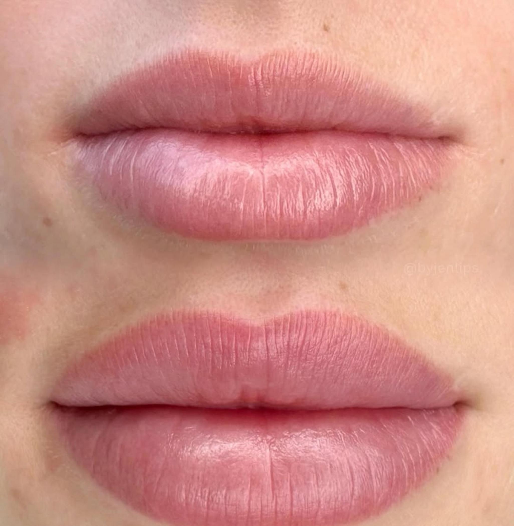 technician applying lip neutralisation pigment