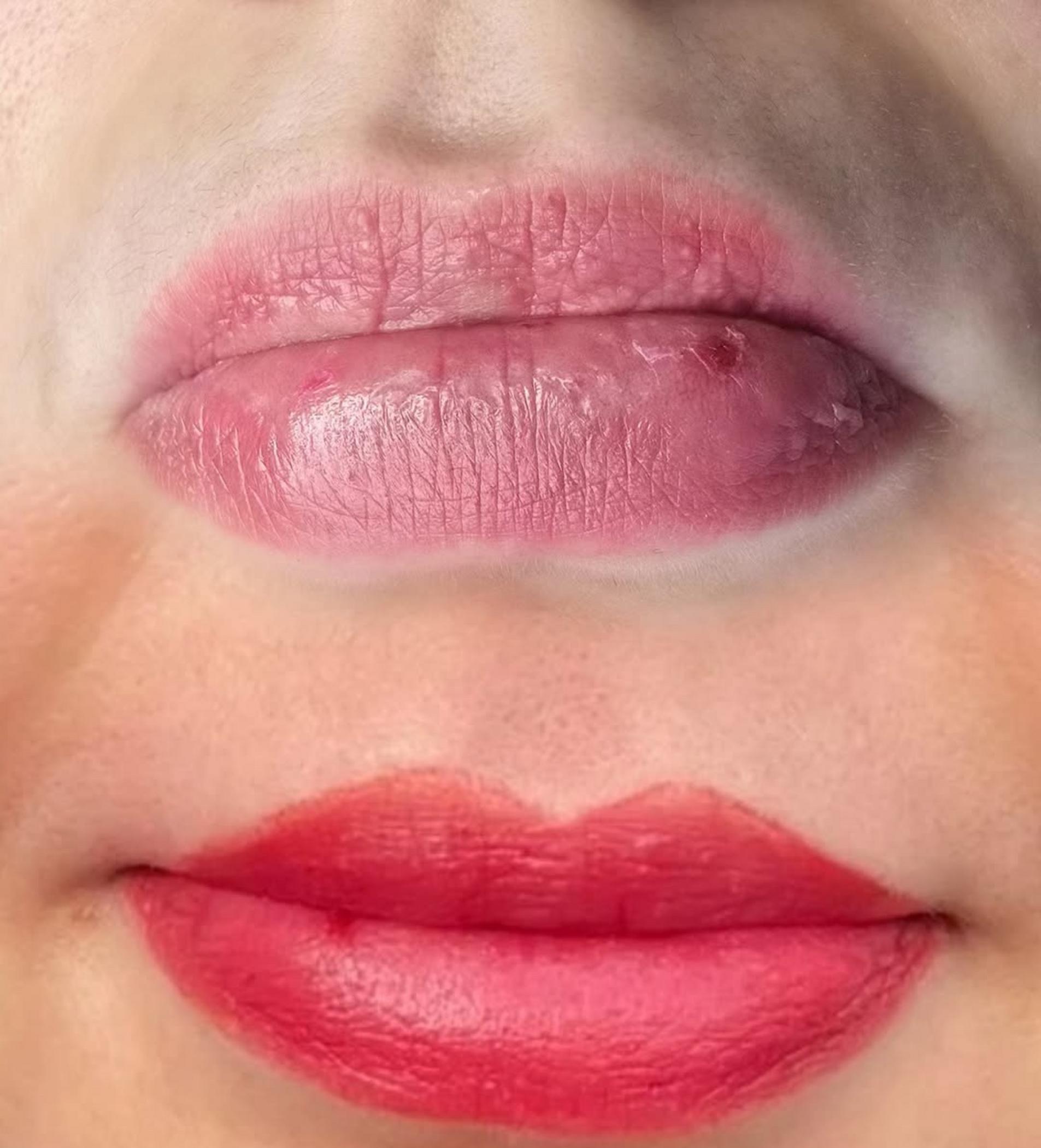technician working on lip contour